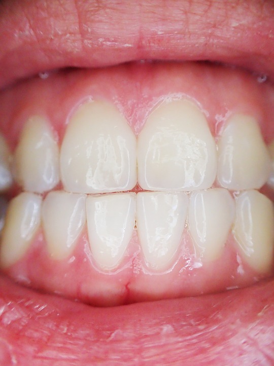 white spots