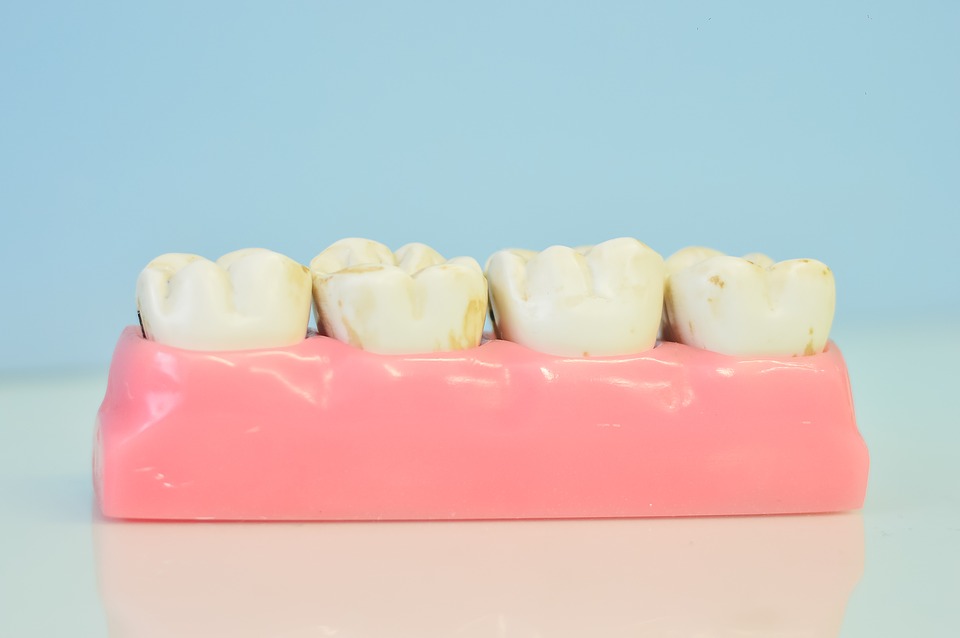 Teeth Removal