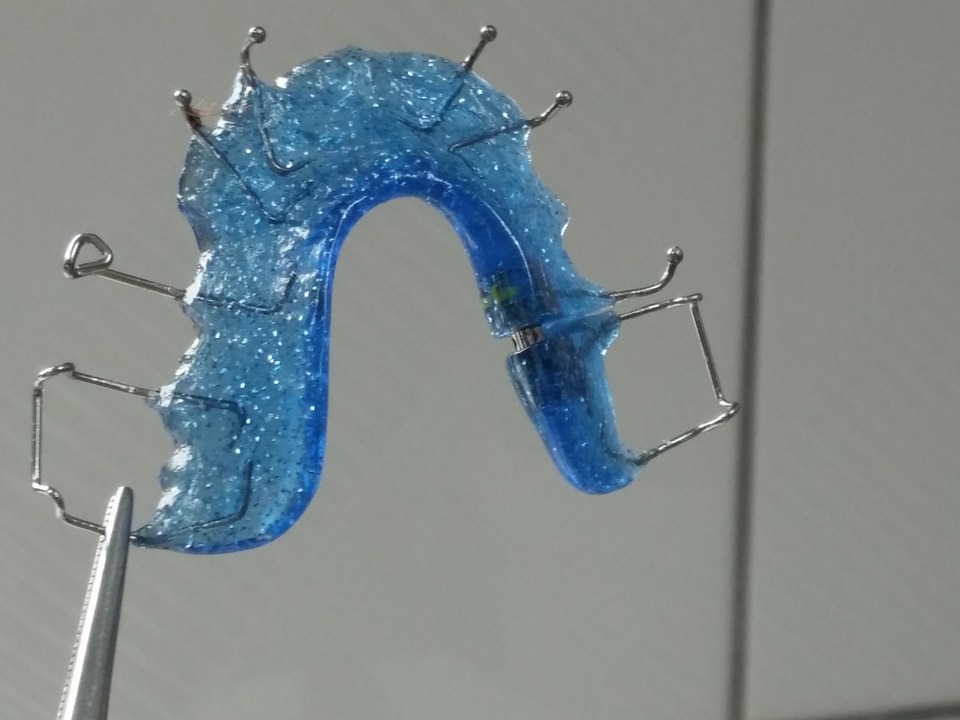 Traditional Braces